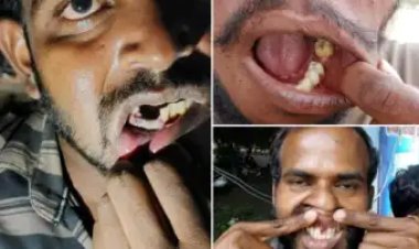 விசாரணை கைதிகளின் பற்களை கல்லால் உடைத்து, அந்தரங்க உறுப்பை நசுக்கிய விவகாரம்: ஏஎஸ்பி மீது விசாரணை நடத்த ஆட்சியர் உத்தரவு!!