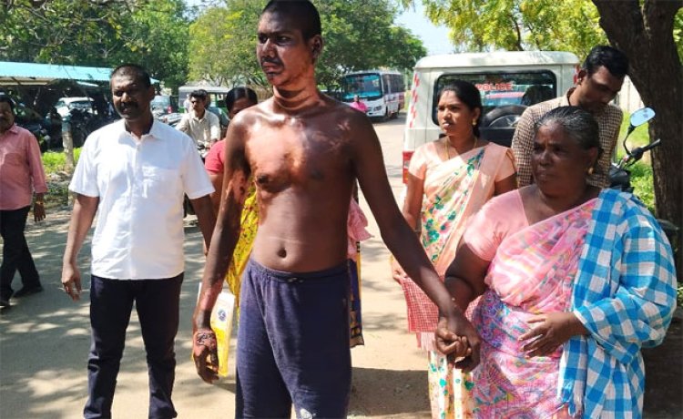 கடலில் மீன்பிடிக்கச் சென்றபோது பெட்ரோல் குண்டுவீச்சில் காயம் அடைந்த மீனவர் : நிவாரணம் வழங்க கோரிக்கை!