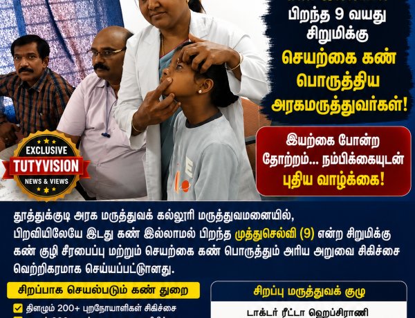 தூத்துக்குடி அரசு மருத்துவமனையில் அரிய சாதனை பிறவியிலேயே கண் இல்லாமல் பிறந்த 9 வயது சிறுமிக்கு செயற்கை கண் பொருத்தி வெற்றிகரமான அறுவை சிகிச்சை